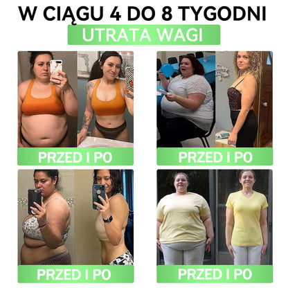 💜💜💜💜ANGELTRAP® Moringa × Berberyna × AMPK 10-w-1 Wsparcie metaboliczne, plaster z nanotechnologią mikroigłową 🇵🇱(Wystarczy raz dziennie, widoczne efekty w 7 dni) ✅ Na otyłość, wiotką skórę, cukrzycę, bezdech senny, problemy ze stawami i wiele innych