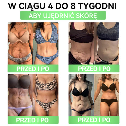 💜💜💜💜ANGELTRAP® Moringa × Berberyna × AMPK 10-w-1 Wsparcie metaboliczne, plaster z nanotechnologią mikroigłową 🇵🇱(Wystarczy raz dziennie, widoczne efekty w 7 dni) ✅ Na otyłość, wiotką skórę, cukrzycę, bezdech senny, problemy ze stawami i wiele innych