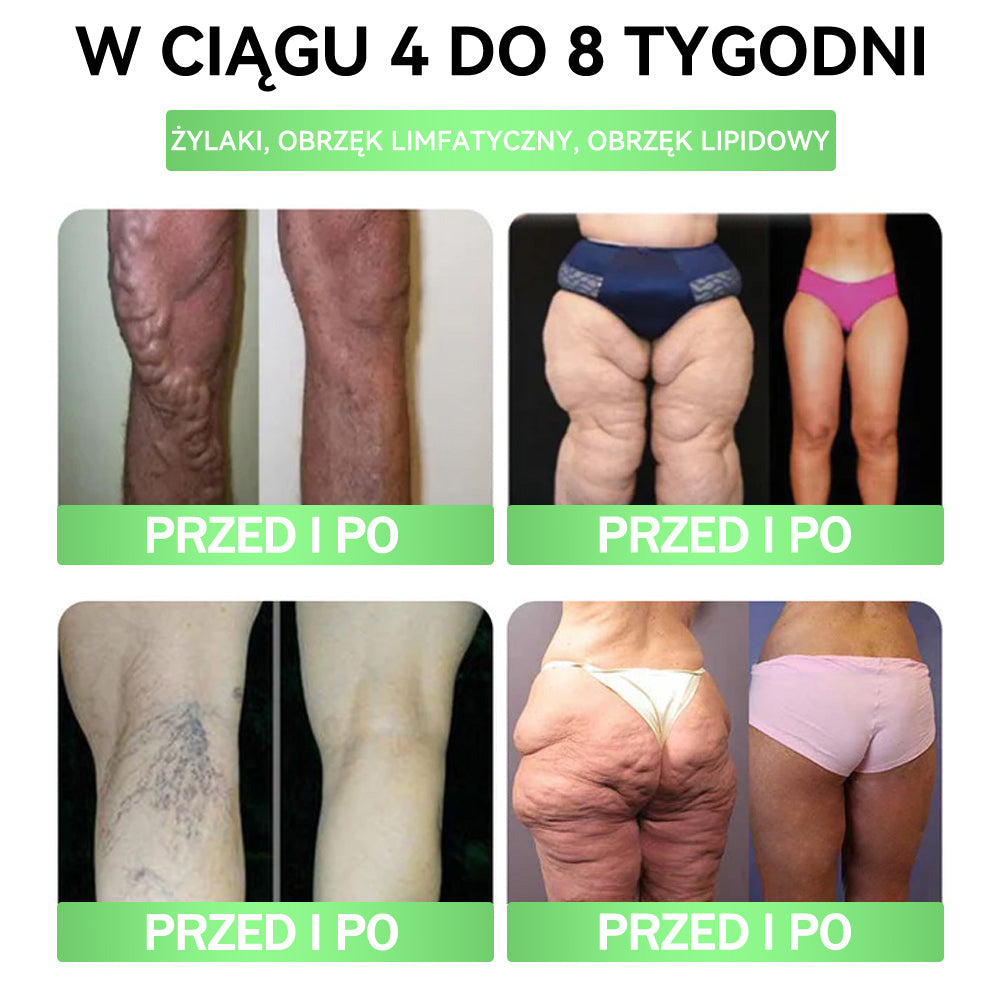 💜💜💜💜ANGELTRAP® Moringa × Berberyna × AMPK 10-w-1 Wsparcie metaboliczne, plaster z nanotechnologią mikroigłową 🇵🇱(Wystarczy raz dziennie, widoczne efekty w 7 dni) ✅ Na otyłość, wiotką skórę, cukrzycę, bezdech senny, problemy ze stawami i wiele innych