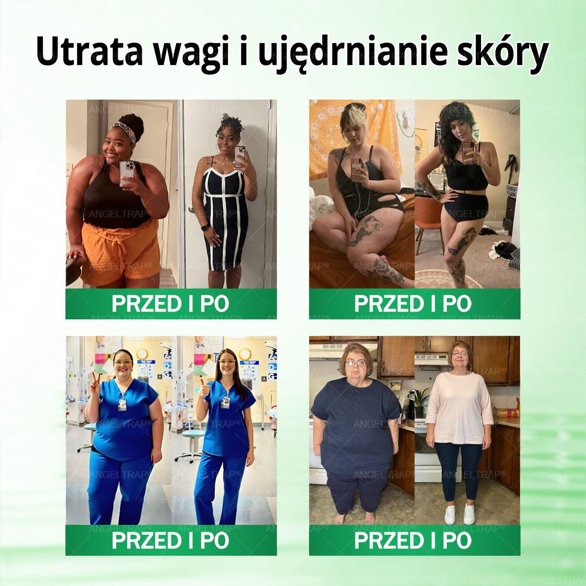 💜💜💜💜ANGELTRAP® Moringa × Berberyna × AMPK 10-w-1 Wsparcie metaboliczne, plaster z nanotechnologią mikroigłową 🇵🇱(Wystarczy raz dziennie, widoczne efekty w 7 dni) ✅ Na otyłość, wiotką skórę, cukrzycę, bezdech senny, problemy ze stawami i wiele innych