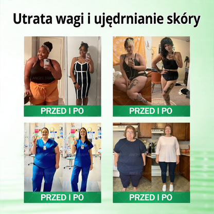 💜💜💜💜ANGELTRAP® Moringa × Berberyna × AMPK 10-w-1 Wsparcie metaboliczne, plaster z nanotechnologią mikroigłową 🇵🇱(Wystarczy raz dziennie, widoczne efekty w 7 dni) ✅ Na otyłość, wiotką skórę, cukrzycę, bezdech senny, problemy ze stawami i wiele innych